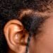 I Got My Scalp Analysed To Help Treat My Natural Hair