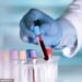 Takeover target: British biopharmaceutical services provider Ergomed has come under attack from  private equity outfit Permira