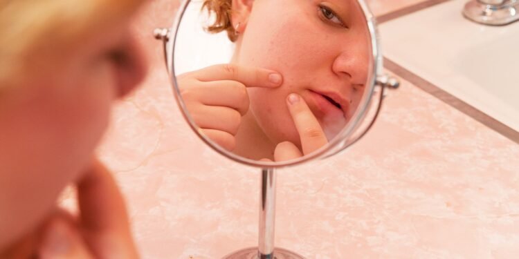 Du benutzt Pickel-Patches? Dann mach nicht meine Fehler