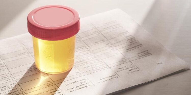 Why You Shouldn't Take A Drug Test If You Know You'll Fail