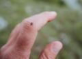 Five Common Mistakes People Make When Checking for Ticks