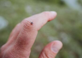 Five Common Mistakes People Make When Checking for Ticks