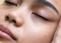 A Derm's Guide To Hypochlorous Acid & Best Face Mists