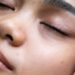 A Derm's Guide To Hypochlorous Acid & Best Face Mists