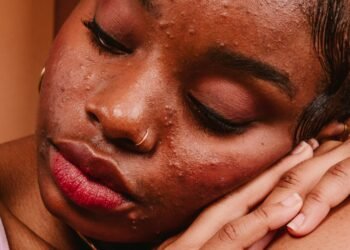 “Acne Safe” Beauty Products Are A Scam — Here’s Why