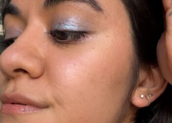 I Thought My Hyperpigmentation Was Acne Scarring — Until A Dermatologist Told Me Otherwise