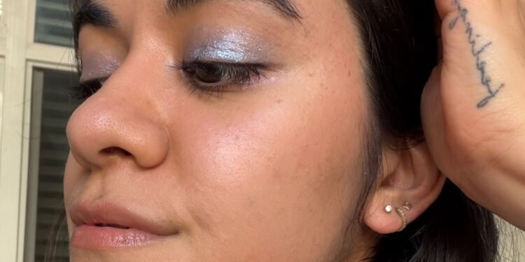 I Thought My Hyperpigmentation Was Acne Scarring — Until A Dermatologist Told Me Otherwise