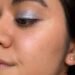 I Thought My Hyperpigmentation Was Acne Scarring — Until A Dermatologist Told Me Otherwise