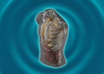 This AI company wants to replace MRIs with a 60-second dip in the spa. Can that really work?